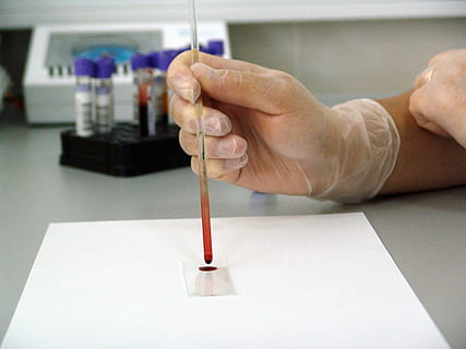 person wearing white gloves holding clear glass hand tool, blood HD wallpaper