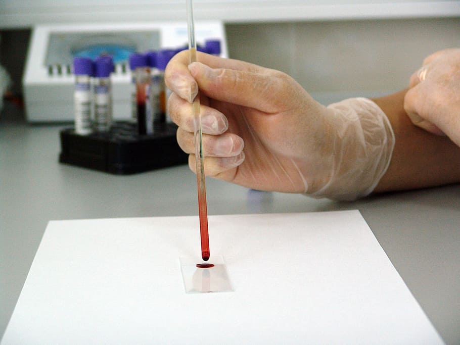 person wearing white gloves holding clear glass hand tool, blood HD wallpaper