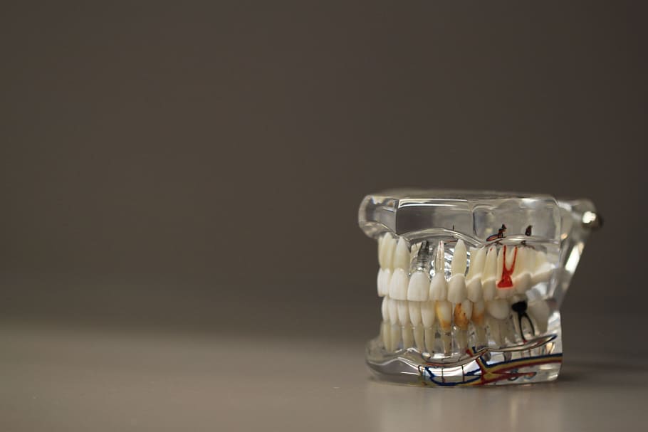 white artificial teetg, dentistry, dentals, teeth, model, jaw, HD wallpaper